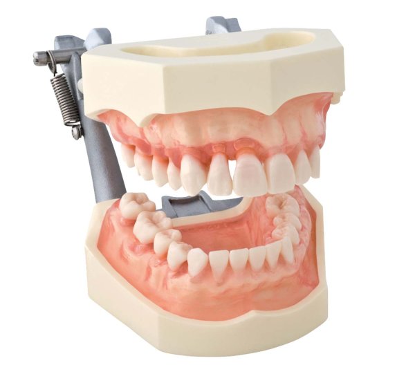 Parodontiemodell mit weichem, transparenten Zahnfleisch P15D-162H1